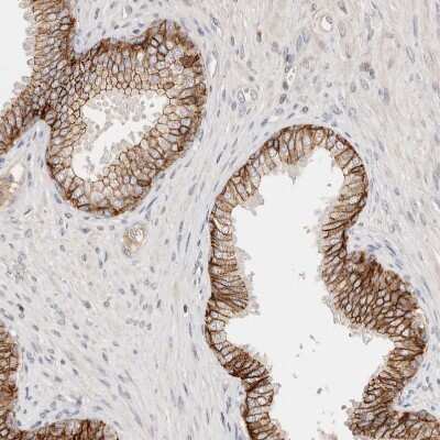 Immunohistochemistry-Paraffin: CXADR Antibody [NBP1-88194]