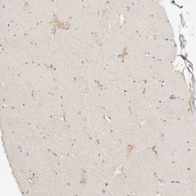 Immunohistochemistry-Paraffin: CXADR Antibody [NBP1-88194]