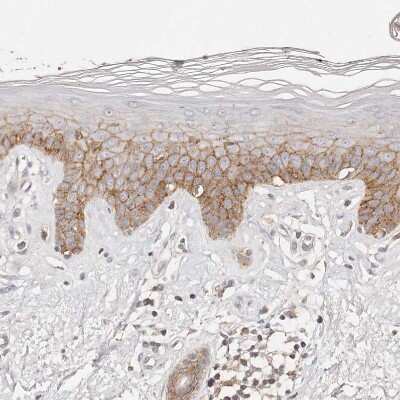 Immunohistochemistry-Paraffin: CXADR Antibody [NBP1-88194]