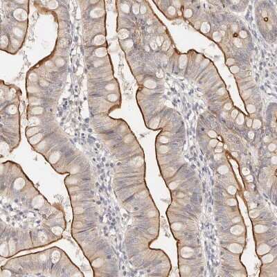 Immunohistochemistry-Paraffin: CXADR Antibody [NBP1-88194]