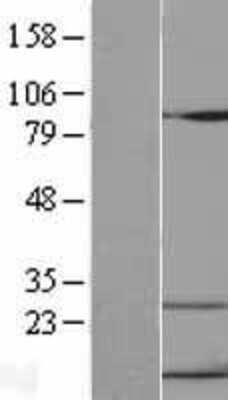 Western Blot: CXCL10/IP-10/CRG-2 Overexpression Lysate [NBL1-09621]