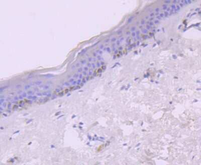 Immunohistochemistry-Paraffin: CXCL10/IP-10/CRG-2 Antibody (JA10-82) [NBP2-67004]