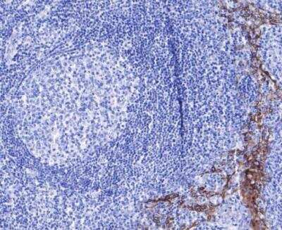 Immunohistochemistry-Paraffin: CXCL10/IP-10/CRG-2 Antibody (JA10-82) [NBP2-67004]