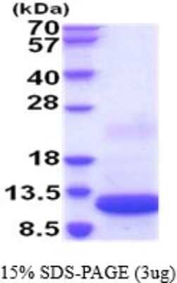 SDS-PAGE: Recombinant Mouse CXCL12/SDF-1 His Protein [NBP2-52161]