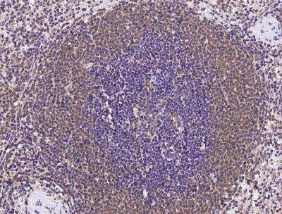 Immunohistochemistry-Paraffin: CXCL12/SDF-1 beta Antibody [NBP3-05880]