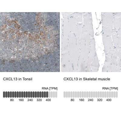 Immunohistochemistry-Paraffin: CXCL13/BLC/BCA-1 Antibody (CL10543) [NBP3-07988]