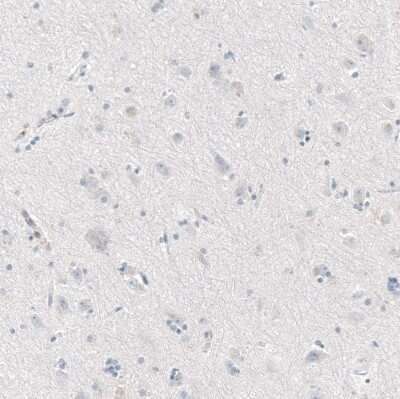 Immunohistochemistry-Paraffin: CXCL13/BLC/BCA-1 Antibody (CL10543) [NBP3-07988]
