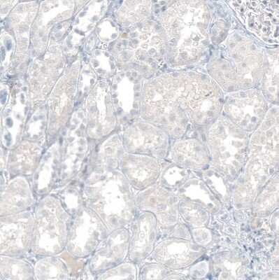 Immunohistochemistry-Paraffin: CXCL13/BLC/BCA-1 Antibody (CL10543) [NBP3-07988]