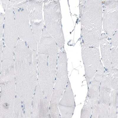 Immunohistochemistry-Paraffin: CXCL13/BLC/BCA-1 Antibody (CL10543) [NBP3-07988]