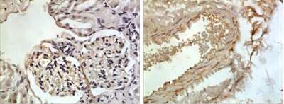 Immunohistochemistry-Paraffin: CXCL13/BLC/BCA-1 Antibody (RM0205-19N1) - Azide and BSA Free [NBP2-12223]