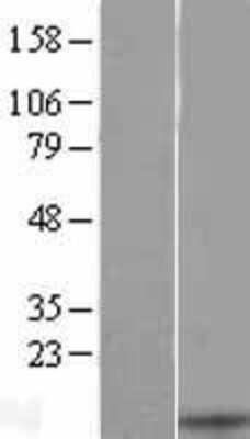 Western Blot: CXCL13/BLC/BCA-1 Overexpression Lysate [NBL1-09624]