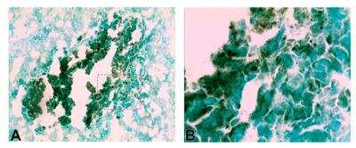 Immunohistochemistry: CXCL14/BRAK Antibody [NBP1-31398]