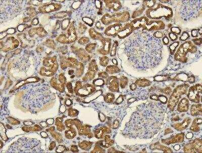 Immunohistochemistry-Paraffin: CXCL14/BRAK Antibody [NBP1-31398]