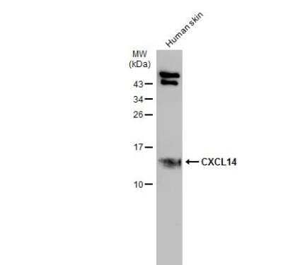 Western Blot: CXCL14/BRAK Antibody [NBP1-31398]