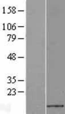 Western Blot: CXCL14/BRAK Overexpression Lysate [NBL1-09625]