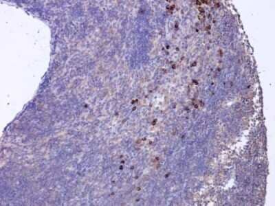 Immunohistochemistry-Paraffin: CXCL16 Antibody (GT516) [NBP3-13519]