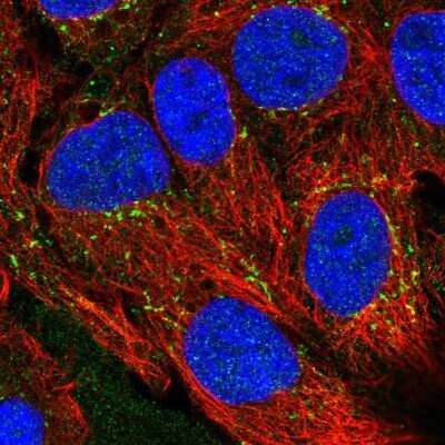 Immunocytochemistry/ Immunofluorescence: CXCL16 Antibody [NBP2-58349]