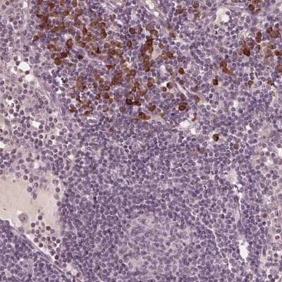 Immunohistochemistry: CXCL16 Antibody [NBP2-39072]