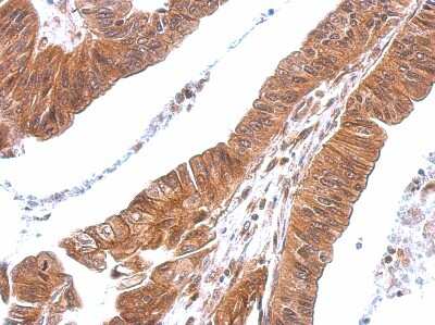 Immunohistochemistry-Paraffin: CXCL16 Antibody [NBP2-16042]