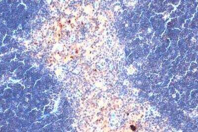 Immunohistochemistry-Paraffin: CXCL16 Antibody [NBP2-16042]