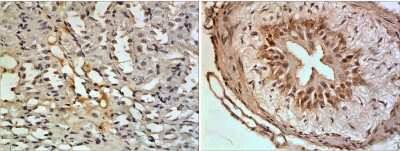 Immunohistochemistry-Paraffin: CXCL16 Antibody (RM0208-15Q2) - Azide and BSA Free [NBP2-12226]