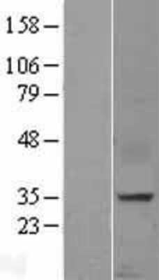 Western Blot: CXCL16 Overexpression Lysate [NBP2-09333]