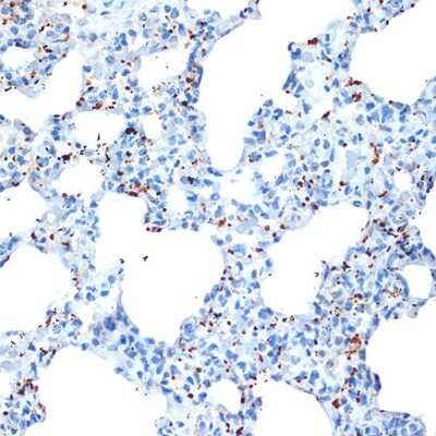 Immunohistochemistry-Paraffin: CXCL4/PF4 Antibody (6Q10H2) [NBP3-16251]