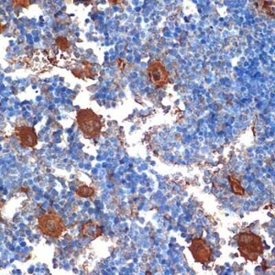 Immunohistochemistry-Paraffin: CXCL4/PF4 Antibody (6Q10H2) [NBP3-16251]