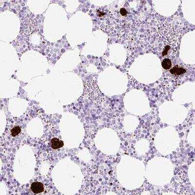 Immunohistochemistry-Paraffin: CXCL4/PF4 Antibody [NBP2-46804]