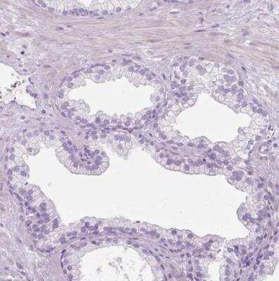Immunohistochemistry-Paraffin: CXCL4/PF4 Antibody [NBP2-46804]