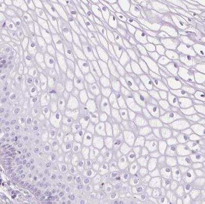Immunohistochemistry-Paraffin: CXCL4/PF4 Antibody [NBP2-46804]
