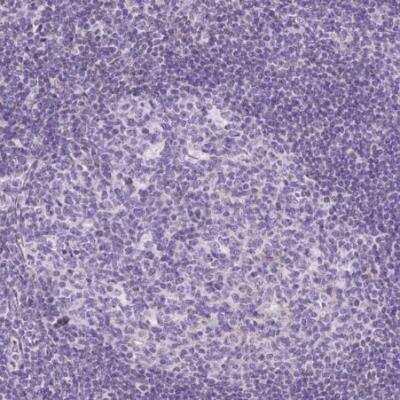 Immunohistochemistry-Paraffin: CXCL4/PF4 Antibody [NBP2-46804]