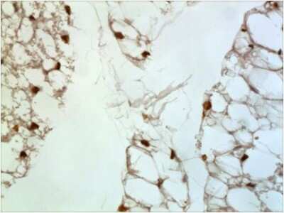 Immunohistochemistry-Paraffin: CXCL4/PF4 Antibody (RM0210-14M15) - Azide and BSA Free [NBP2-12230]