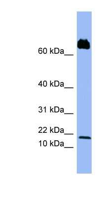 Western Blot: CXCL4L1 Antibody [NBP1-70510]