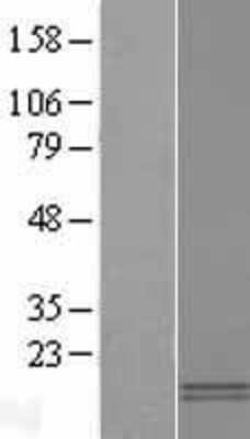 Western Blot: CXCL4L1 Overexpression Lysate [NBP2-10840]