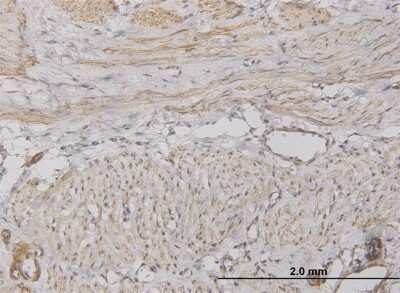 Immunohistochemistry-Paraffin: CXCL5/ENA-78 Antibody (2A9) [H00006374-M05]
