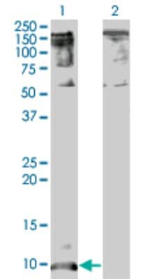 Western Blot: CXCL5/ENA-78 Antibody (2A9) [H00006374-M05]