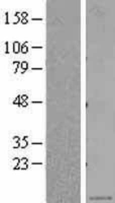 Western Blot: CXCL5/ENA-78 Overexpression Lysate [NBL1-09628]