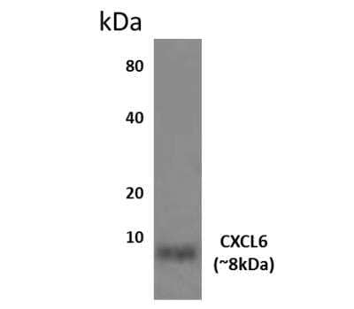 Western Blot: CXCL6/GCP-2 Antibody (MM0217-10L25)Azide and BSA Free [NBP2-12232]