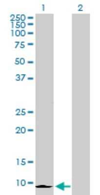 Western Blot: CXCL6/GCP-2 Antibody [H00006372-D01P]