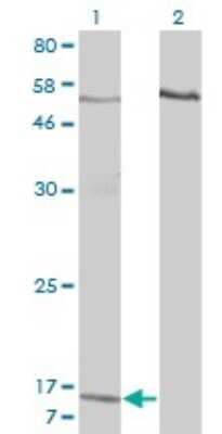 Western Blot: CXCL7/NAP-2 Antibody (3B9) [H00005473-M01]