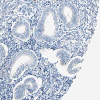 Immunohistochemistry-Paraffin: CXCL7/NAP-2 Antibody [NBP1-89921]
