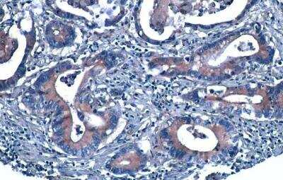 Immunohistochemistry-Paraffin: CXCL8/IL-8 Antibody [NBP2-16958]