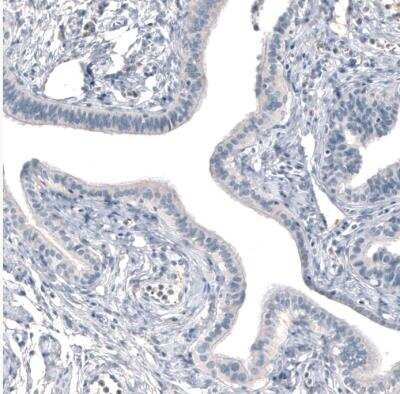 Immunohistochemistry-Paraffin: CXCL8/IL-8 Antibody [NBP2-33819]
