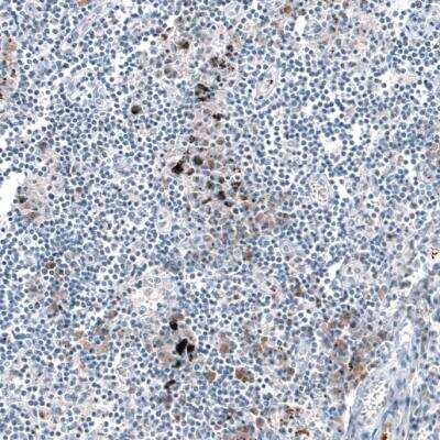 Immunohistochemistry-Paraffin: CXCL8/IL-8 Antibody [NBP2-33819]