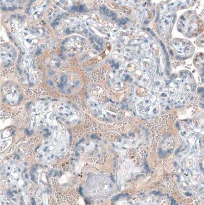 Immunohistochemistry-Paraffin: CXCL8/IL-8 Antibody [NBP2-33819]
