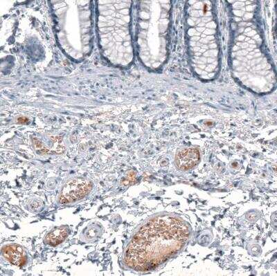 Immunohistochemistry-Paraffin: CXCL8/IL-8 Antibody [NBP2-33819]