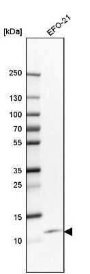 Western Blot: CXCL8/IL-8 Antibody [NBP2-33819]