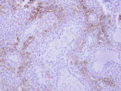 Immunohistochemistry-Paraffin: CXCL9/MIG Antibody [NBP1-31155]