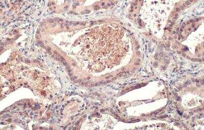 Immunohistochemistry-Paraffin: CXCL9/MIG Antibody [NBP1-31155]
